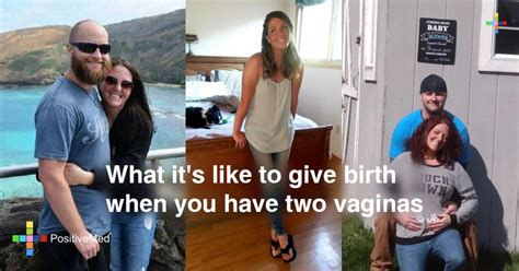 can you have 2 vaginas|What Its Like to Give Birth When You Have Two。